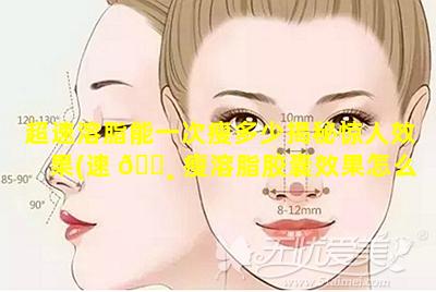 超速溶脂能一次瘦多少揭秘惊人效果(速 🕸 瘦溶脂胶囊效果怎么样)